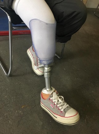 Lower limbs prosthesis